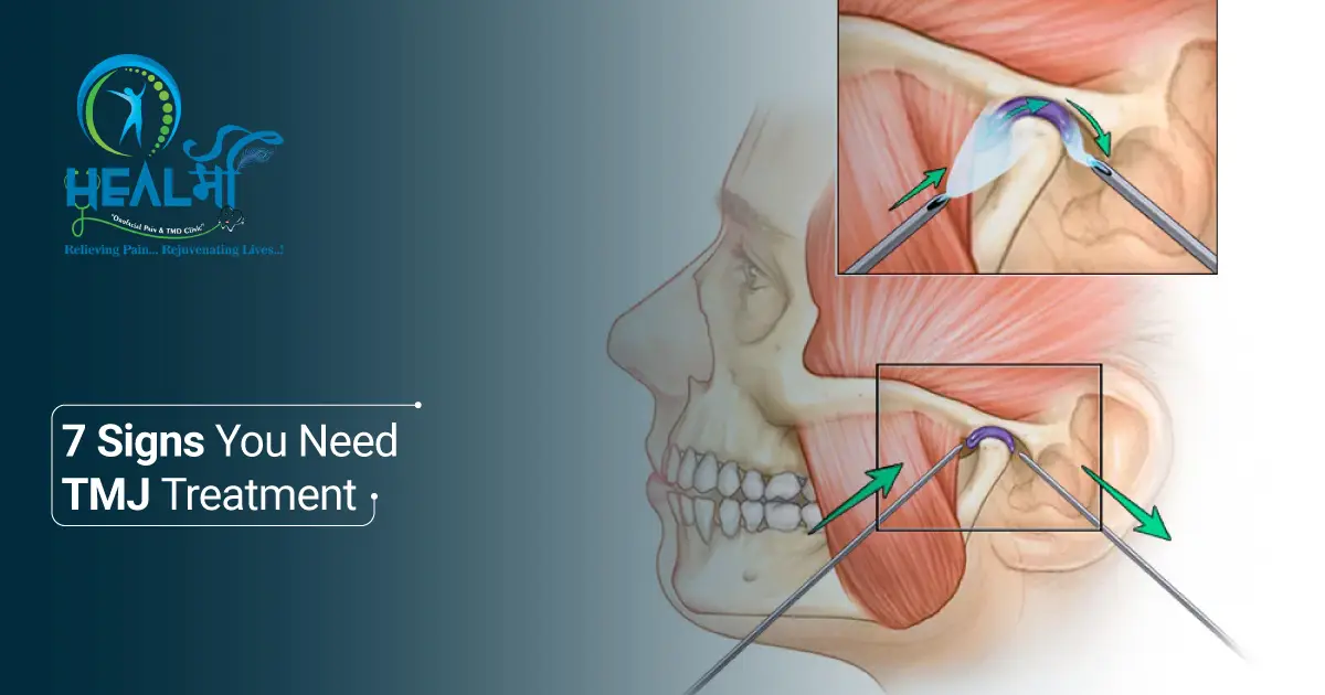 Signs You Need TMJ Treatment