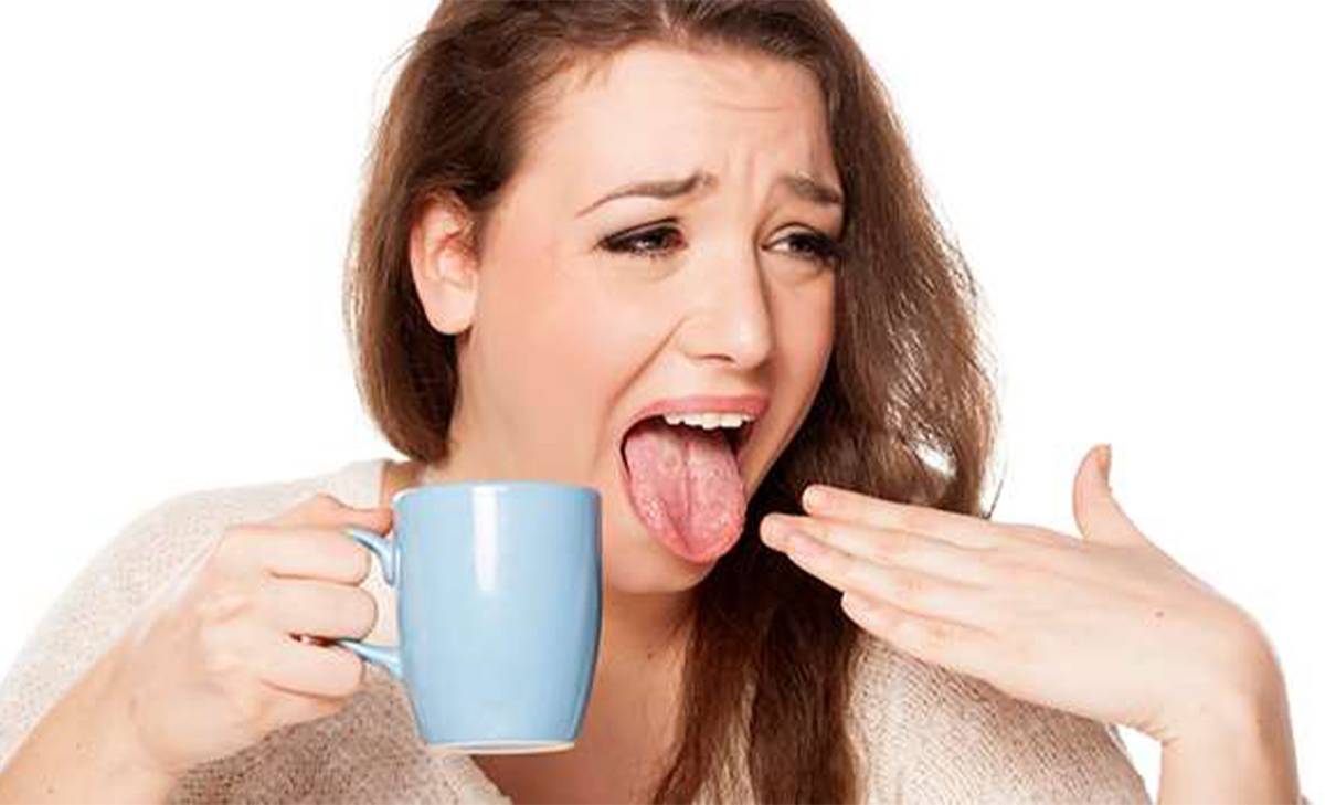 Burning Mouth Syndrome