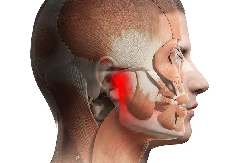 TMJ Disorders