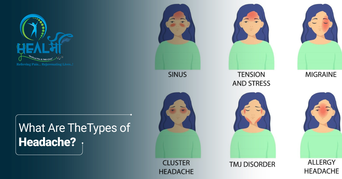 Types of Headache Types of Headache